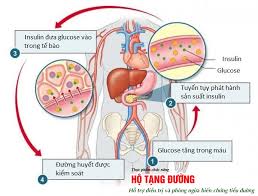 Đề kháng insulin - Hình ảnh minh họa